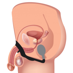 10X P-Bomb Silicone Cock & Ball Ring with Vibrating Anal Plug
