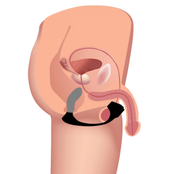 Silicone Prostate Vibe with Cock Ring and Remote