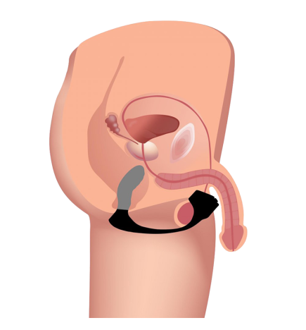 Silicone Prostate Vibe with Cock Ring and Remote